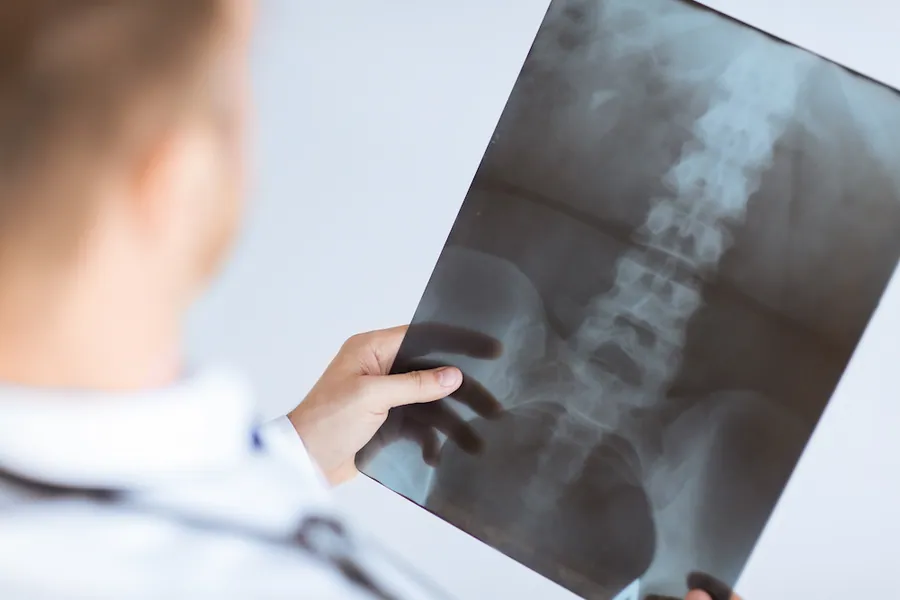 Spine X-Ray at Catalyst Chiropractic And Rehab in Blaine, MN
