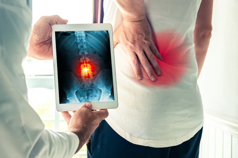 Spine X-Ray in Blaine, MN