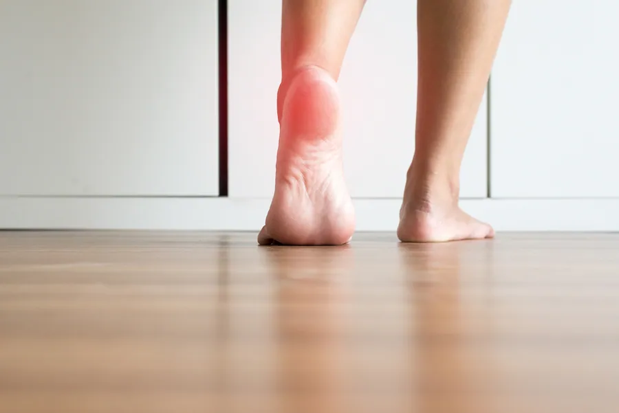 Plantar Fasciitis at Catalyst Chiropractic And Rehab in Blaine, MN